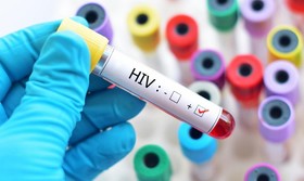 روابط جنسی بیشترین علت بروز HIV در ۱۴۰۱/ چرایی افزایش سهم زنان مبتلا
