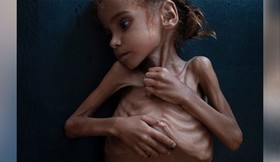 مرگ دختر بچه‌ی یمنی که تصویرش جهان را تکان داد