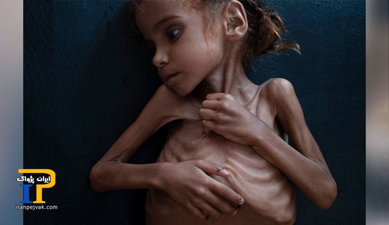 دختر یمنی