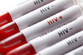 آخرین آمار ایدز در کشور/ تغییر الگوی انتقال بیماری