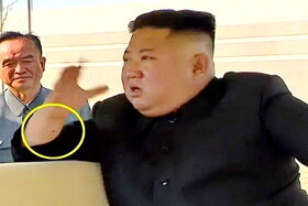 راز جای سوزن روی دست رهبر کره شمالی چیست؟
