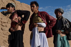 دهکده‌ی «یک کلیه‌ها» در افغانستان