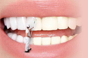با این روش خانگی و ساده سفیدترین دندان‌ها را داشته باشید