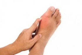 آرتروز انگشت شست پا چیست؟